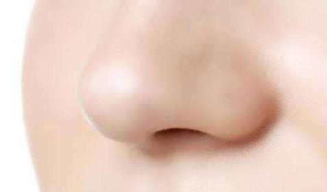 西安美萊雙眼皮手術，王鵬醫(yī)生項目與價格揭秘