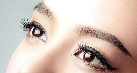 北京張誠(chéng)醫(yī)生雙眼皮成效及案例揭秘