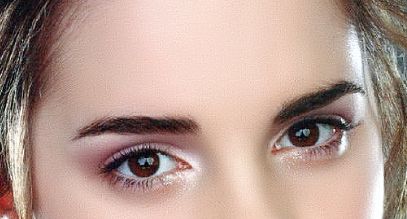 哈爾濱伊美爾醫(yī)院黃志祥醫(yī)生隆鼻手術(shù)費(fèi)用預(yù)估！真實(shí)案例分享讓你了解隆鼻效果！