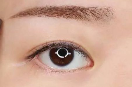 席靜醫(yī)生技術(shù)與北京豐臺醫(yī)院專家分享熱瑪吉案例，價格表一并奉上