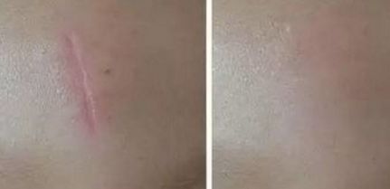 李衍江個(gè)人資料與除皺案例分享-院長(zhǎng)專業(yè)技術(shù)與價(jià)格解析