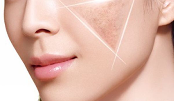 杭州最棒的整形醫(yī)生，給你帶來完美的仿鼻整形案例