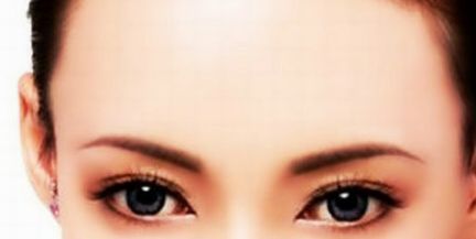 重慶醫(yī)科附一醫(yī)院張恒術(shù)醫(yī)生雙眼皮技術(shù)驗(yàn)真實(shí)過(guò)程！