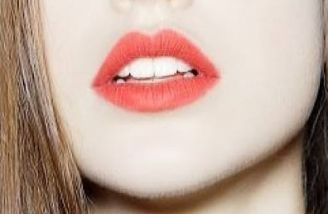 廣州瑰麗詩醫(yī)療美容：專業(yè)塑造雙眼皮，醫(yī)學專家為您解析完美案例