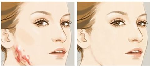 解密上海九院眼部整形高手周—雄醫(yī)生的術(shù)中絕活及成功案例！