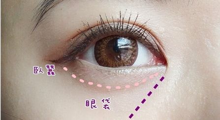 湖州市中心醫(yī)院整形科鼻部手術(shù)有何效果？親測80天輕松告訴你