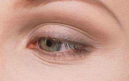 張余光治療眼袋的效果如何？醫(yī)院環(huán)境和治療案例展示會(huì)給您答案