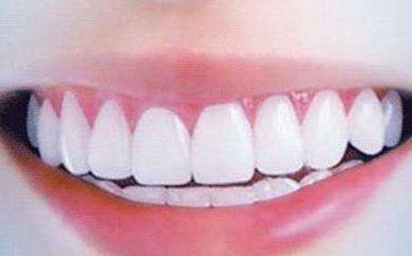 福建鄭勝武隆胸案例分享，醫(yī)術(shù)嫻熟如何？價(jià)目表附，了解一下！