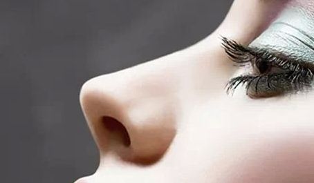 廈門(mén)張安利雙眼皮修復(fù)經(jīng)驗(yàn)分享，效果超乎預(yù)期！雙眼皮修復(fù)詳解