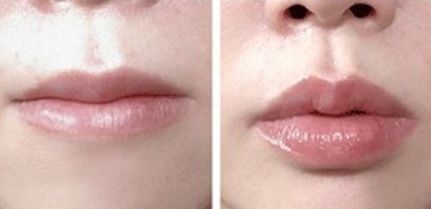 沈陽經(jīng)過篩選的整形醫(yī)院公立醫(yī)院推薦，手術(shù)過程圖解！