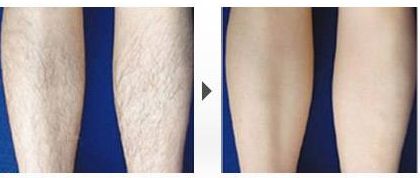 南京張少博醫(yī)生如何進行鼻部整形？經(jīng)驗分享及成功案例分享