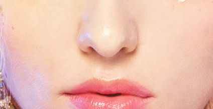 趙軍艦醫(yī)生進(jìn)行面部脂肪填充效果如何？案例展示供參考