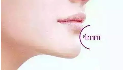 2023年上海最受歡迎的隆胸醫(yī)生排名！詳細介紹馮少清、董佳生、江華醫(yī)生