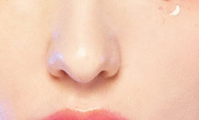 2023年金華雙眼皮整形醫(yī)生口碑評(píng)價(jià)，童蕓、徐捷、胡維君等的綜合排名前10