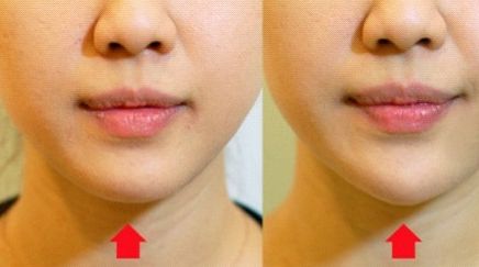 江蘇省人民醫(yī)院整形科醫(yī)師陣容強(qiáng)大！他們實(shí)力可嘉，不容錯(cuò)過！