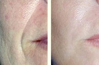 貴陽(yáng)麗都醫(yī)院最新整形案例分享！鼻部整容效果全新曝光