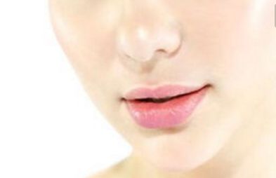 吉林大學(xué)第一醫(yī)院整形科雙眼皮最近有什么新進(jìn)展？案例分享