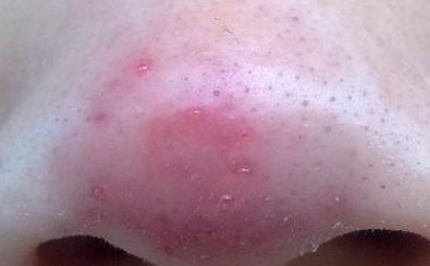 金華雙眼皮手術(shù)，哪位醫(yī)生值得信賴？專家評選揭曉，五位醫(yī)生備受推崇！手術(shù)攻略與價格一覽！