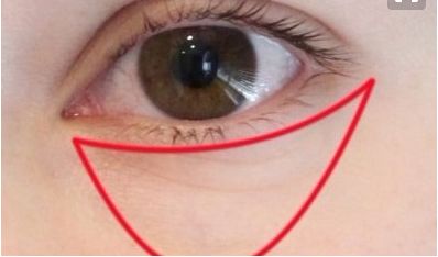 上海仁愛整形劉先超鼻子效果如何？好評案例詳解，價格咨詢！