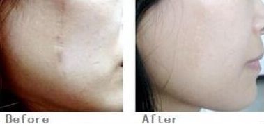 2023杭州鼻骨整形專家排名披露，名醫(yī)排行大揭曉！