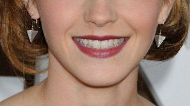 年度最佳技術(shù)大揭秘！龍劍虹注重細(xì)節(jié)，讓雙眼皮優(yōu)雅呈現(xiàn)