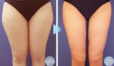 宋金榮雙眼皮手術(shù)效果醫(yī)生口碑評價(jià)及真實(shí)照片分享