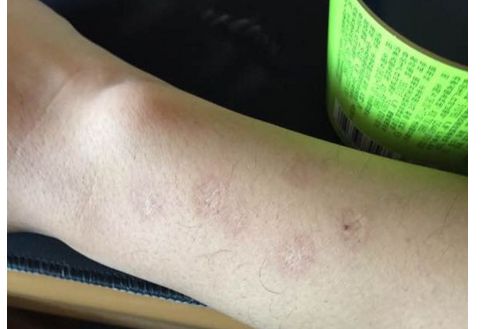 青島雙眼皮大師孫好杰：醫(yī)術(shù)精湛，技術(shù)贊嘆！醫(yī)生背景揭秘！