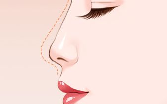 韓國兩位醫(yī)生對比，顴骨整形案例全解析！