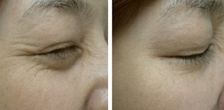 上海九院豐脂達人薈萃！5大醫(yī)師攜超前審美領航，個人簡介與收費揭秘~