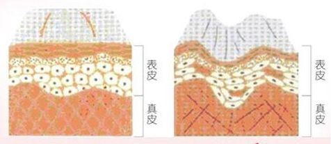 福州雙眼皮手術(shù)，五位醫(yī)生實(shí)力PK！技術(shù)能力對比，各有所長！