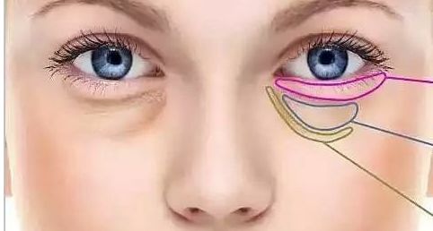 中國(guó)醫(yī)學(xué)科學(xué)院整形外科醫(yī)院劉珍君醫(yī)生的腰腹吸脂技術(shù)能力如何？分享一例成功案例