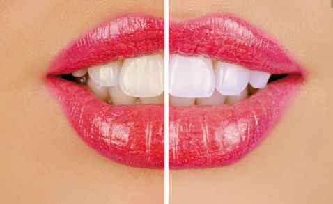 2023西安雙眼皮整形醫(yī)生綜合評價，一覽趙永政、劉小剛、王艷娜等5位專家豪華陣容