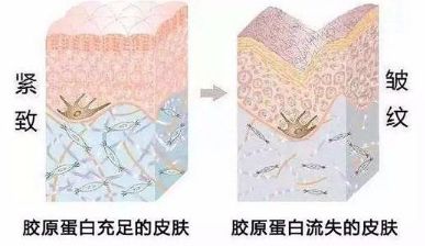 濟南整形醫(yī)院巔峰時刻！面部注射玻尿酸祛皺案例大揭秘