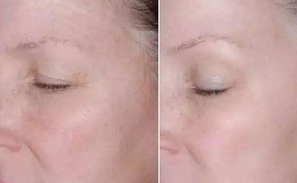 長沙亞韓醫(yī)學(xué)美容醫(yī)院醫(yī)生及門診時間全揭秘