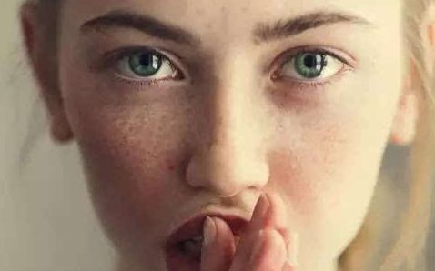 不用擔(dān)心！成都李競(jìng)醫(yī)生雙眼皮術(shù)：80天見證，效果驚艷