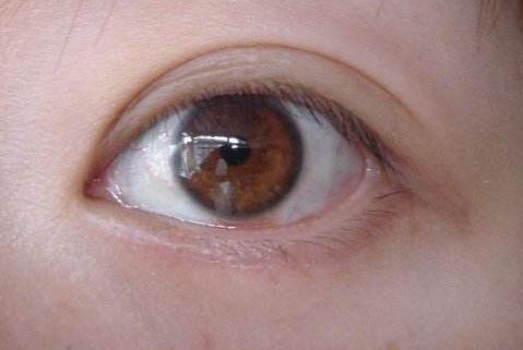 上海九院整形科曹德君實力解析，祛皺經(jīng)驗分享！