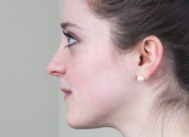 深圳隆胸求推薦？季瀅、李萬醫(yī)生對比！附胡華新案例&價(jià)格表參考