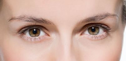 廣州唐畢做全切雙眼皮示范，師傅技藝展示+真實(shí)案例分享