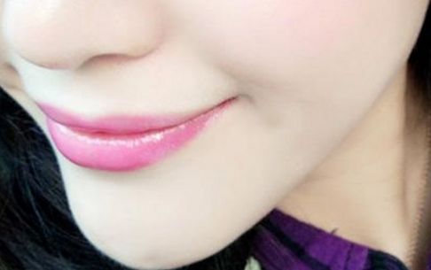 哈爾濱索菲整形美容醫(yī)院專家分享張慧穎醫(yī)生簡(jiǎn)介及成功吸脂案例