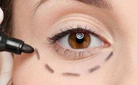 西京醫(yī)院金長(zhǎng)鑫鼻子整形價(jià)格及費(fèi)用介紹