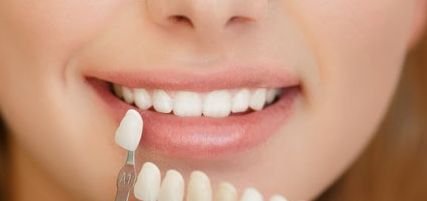 蘇薇潔醫(yī)生雙眼皮手術(shù)效果非常滿(mǎn)意，手術(shù)費(fèi)用參考清單來(lái)啦！