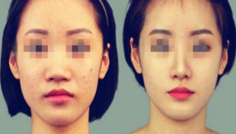 鄭州啤酒肚醫(yī)院全攻略：2024年度前十排名精選