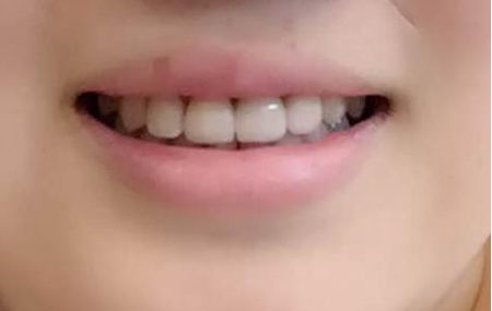 重慶市哪家整形醫(yī)院豐胸好，快速擴(kuò)充您的美麗魅力！