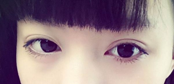 重慶面部輪廓整形醫(yī)院評選榜單揭曉