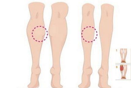 廣州美容醫(yī)生解讀，暢談吸脂技術專長，走紅網(wǎng)絡！