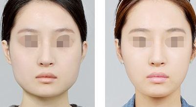 鹽城除皺美容術(shù)口碑好醫(yī)院排行  十大整形專家好評(píng)來襲