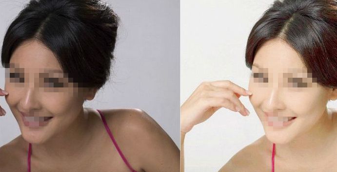 南京首屈一指的頭部SPA醫(yī)院排行榜