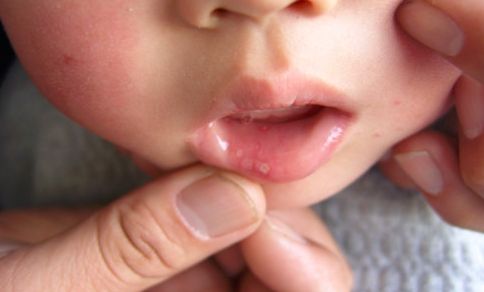 南京哪家醫(yī)院的面部抽脂效果比較好？