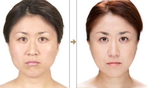 昆明線雕提升整形名醫(yī)口碑榜  權(quán)威機構(gòu)認證