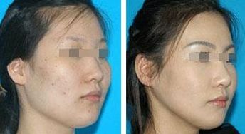 大同地區(qū)優(yōu)質(zhì)美容整形醫(yī)院推薦